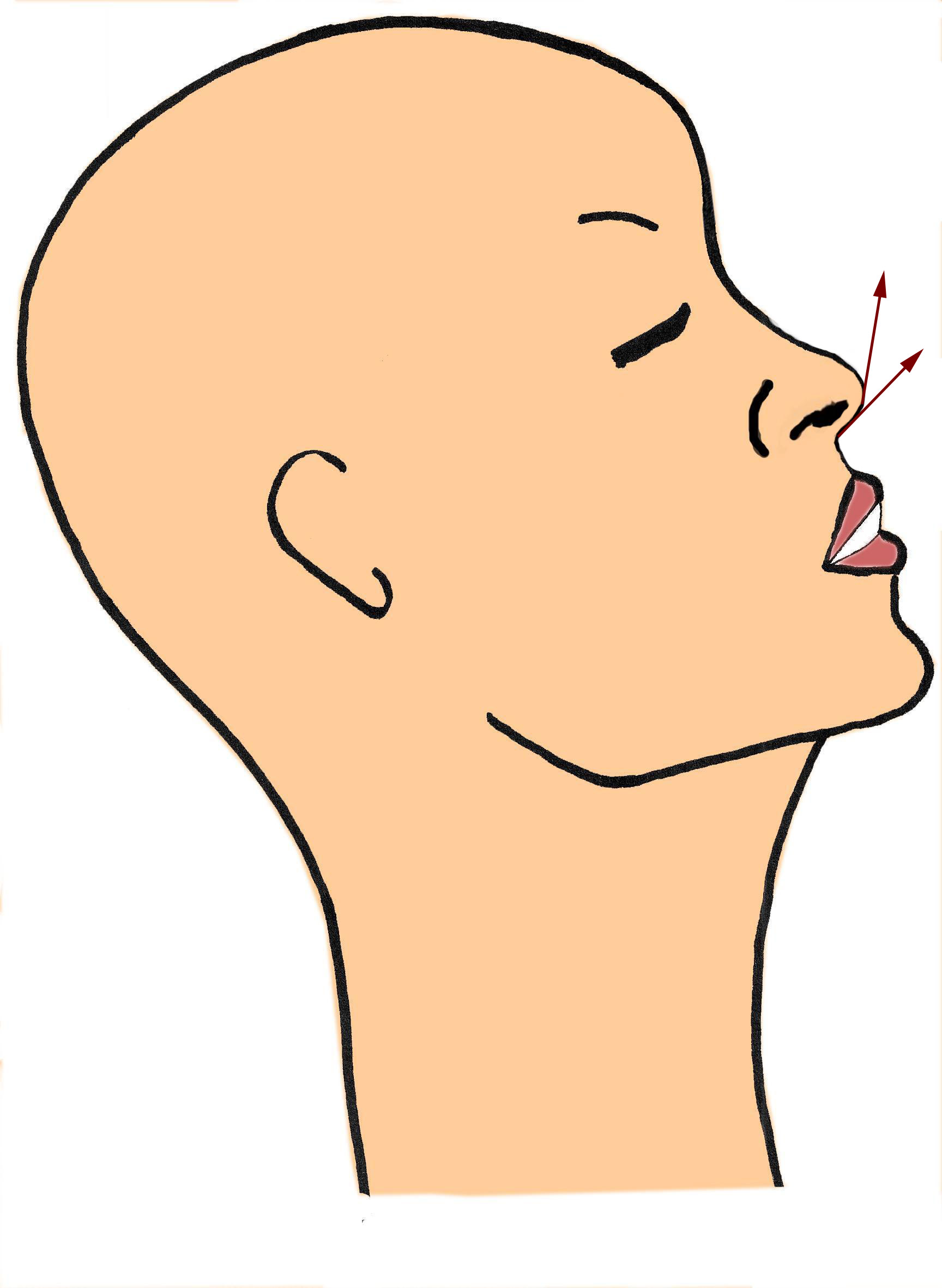angle-lobulocolumellaire-pointe-ne-rhinoplastie-chirurgie-esthetique