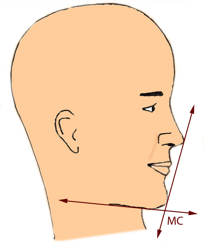 angle-mentocervical-rhinoplastie-chirurgie-esthetique