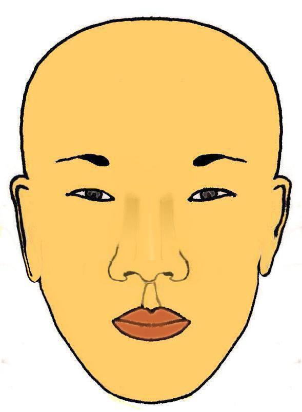 asiatique-face-gros-nez-rhinoplastie-chirurgie-esthetique