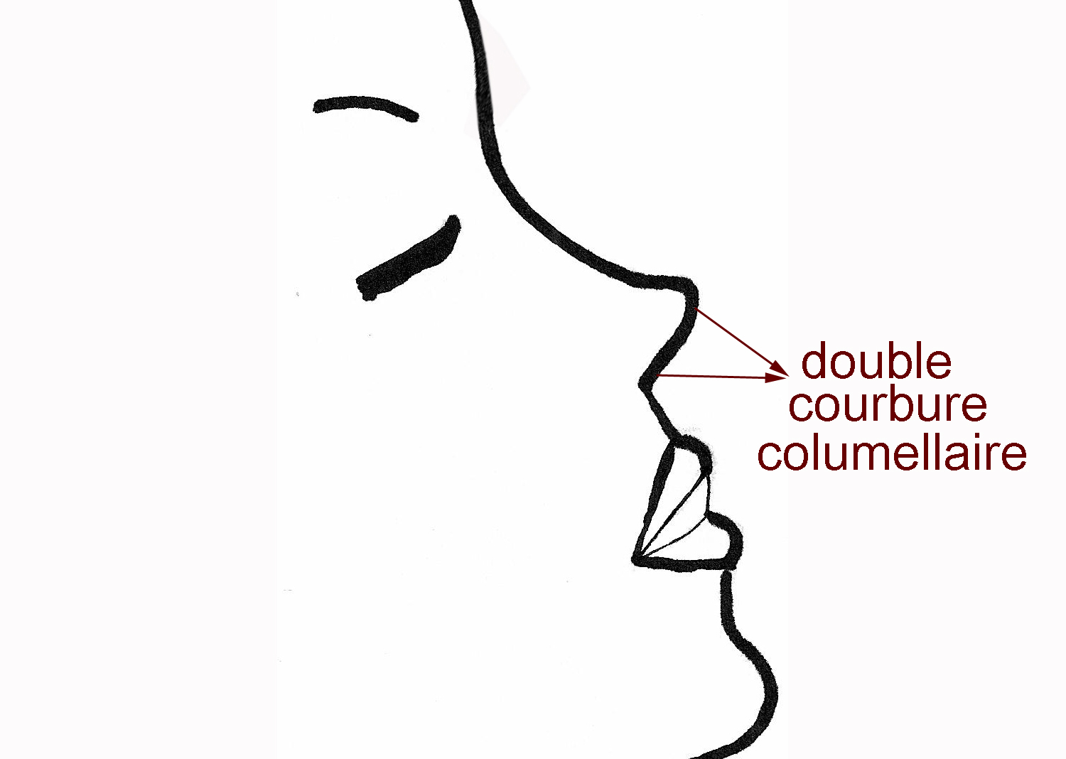doublecourbure-columelle-rhinoplastie-chirurgie-esthetique-nez