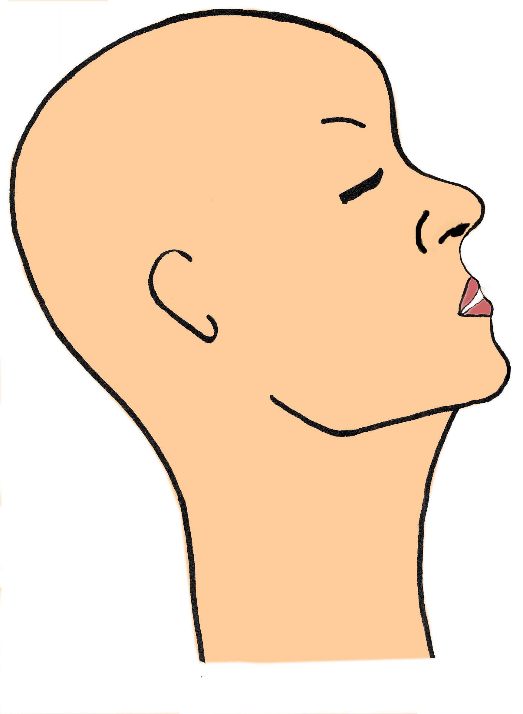 gros-nez-retrusion-maxillaire-mandibule-rhinoplastie-chirurgie-esthetique